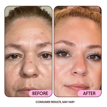 Moisturizing Cream Anti-Aging